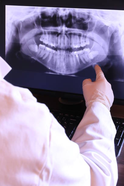 Best Dental Abscess Treatment in Whitmore Lake, MI