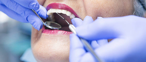 Best Broken or Chipped Tooth Repair in Whitmore Lake, MI